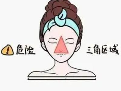 痘痘危险三角区在哪 痘痘危险三角区图片