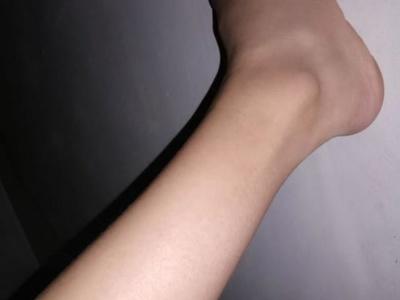 女生刮腿毛会越刮越多吗 女生腿毛会越多